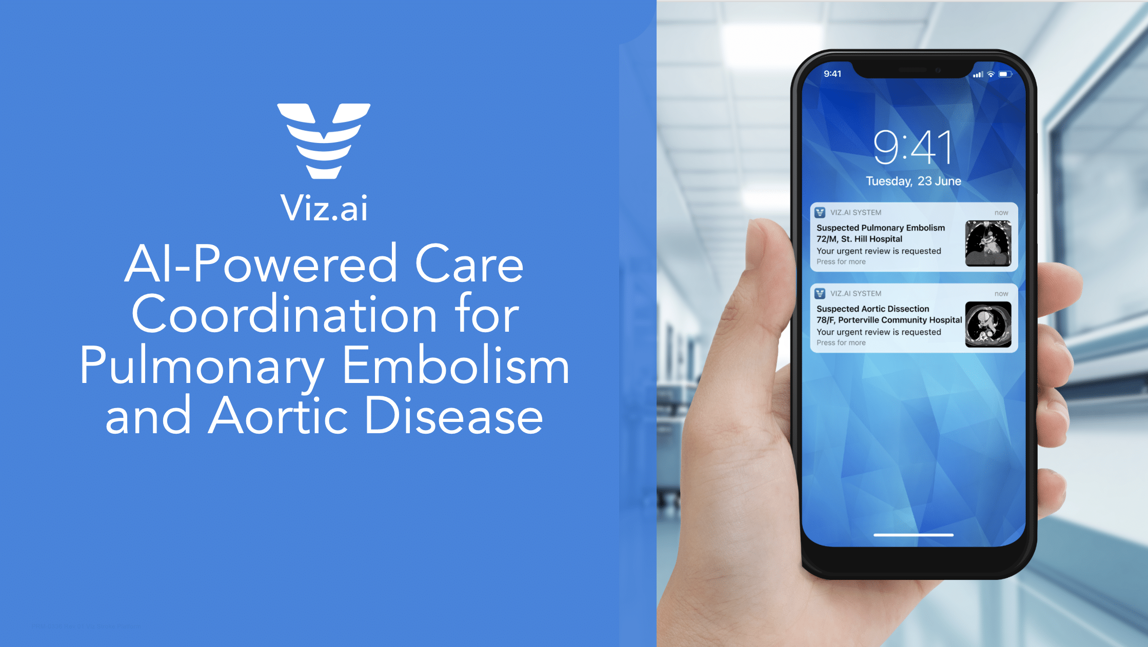 Opening a New Chapter in AI-Powered Care Coordination: Pulmonary Embolism and Aortic Disease