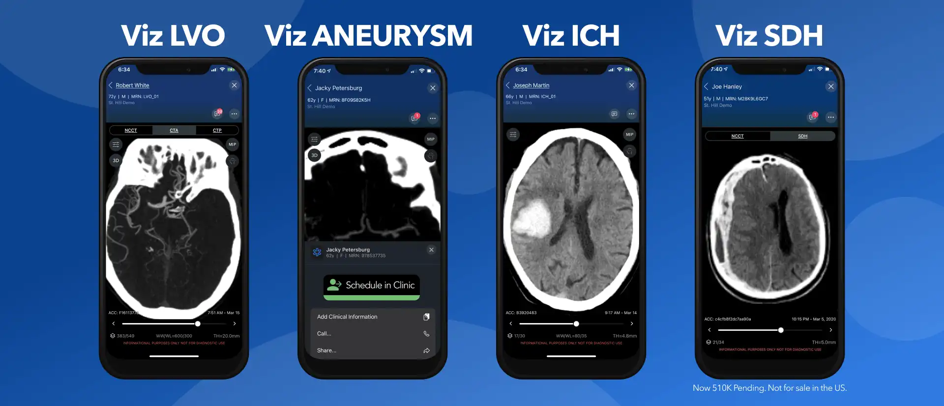 Viz.ai Neurovascular Impact Continues to Expand