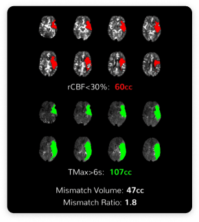 ctp-inset