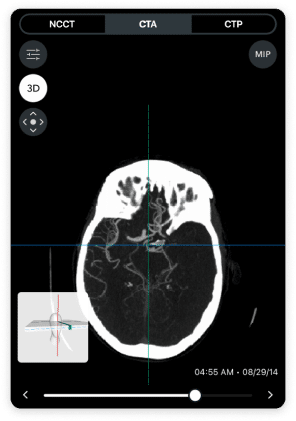 lvo-inset