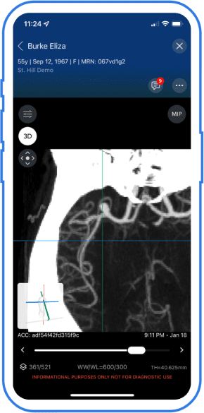 neuro-comprehensive-aneurysm