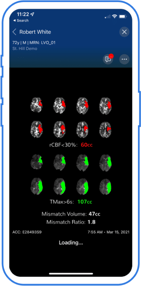 neuro-comprehensive-ctp