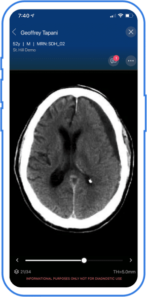 neuro-comprehensive-subdural