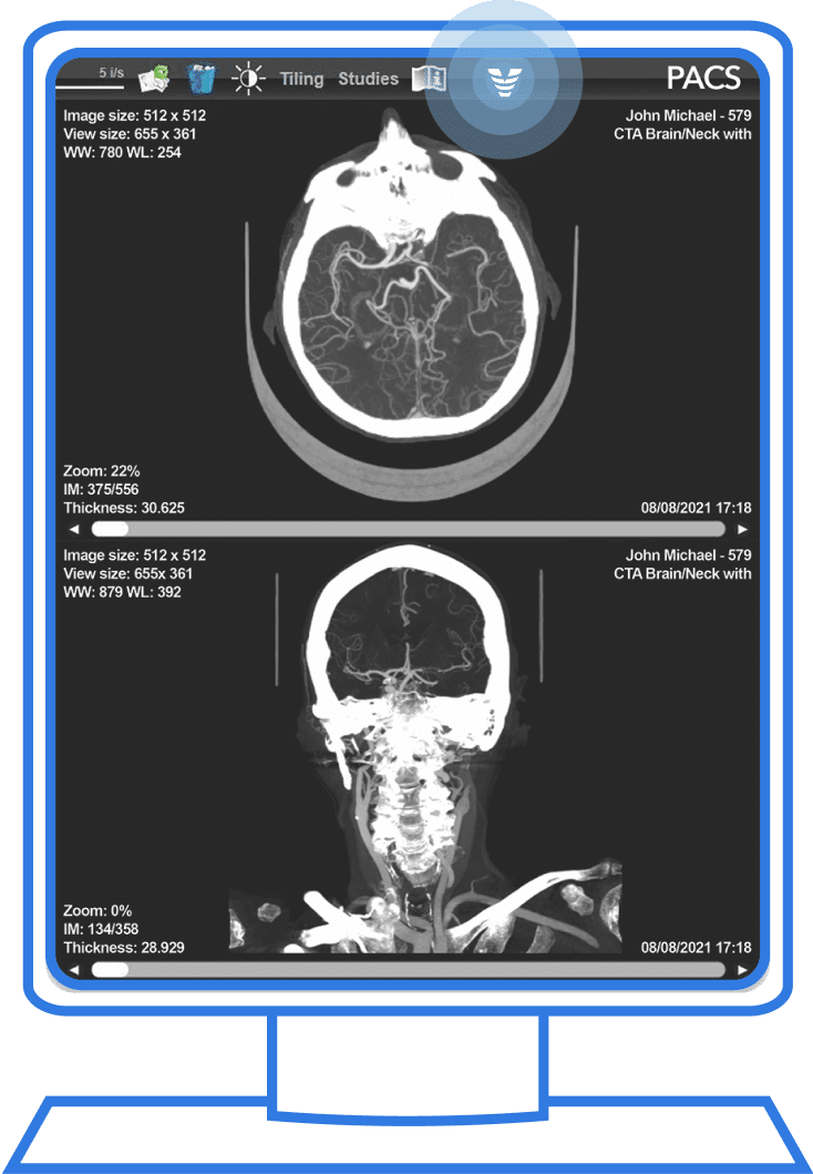 radiology-comprehensive-pacs