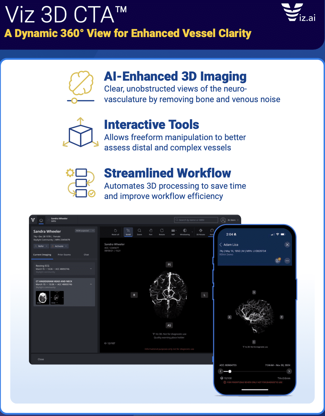 AI-enhanced 3D CTA imaging