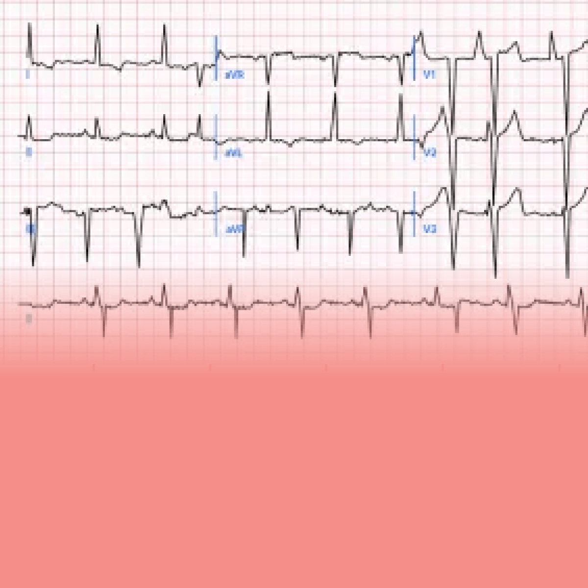 Viz.ai at ASE 2026 | AI-Powered Cardiology Care Coordination